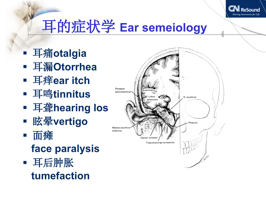 耳聋与听力图分析_第2页