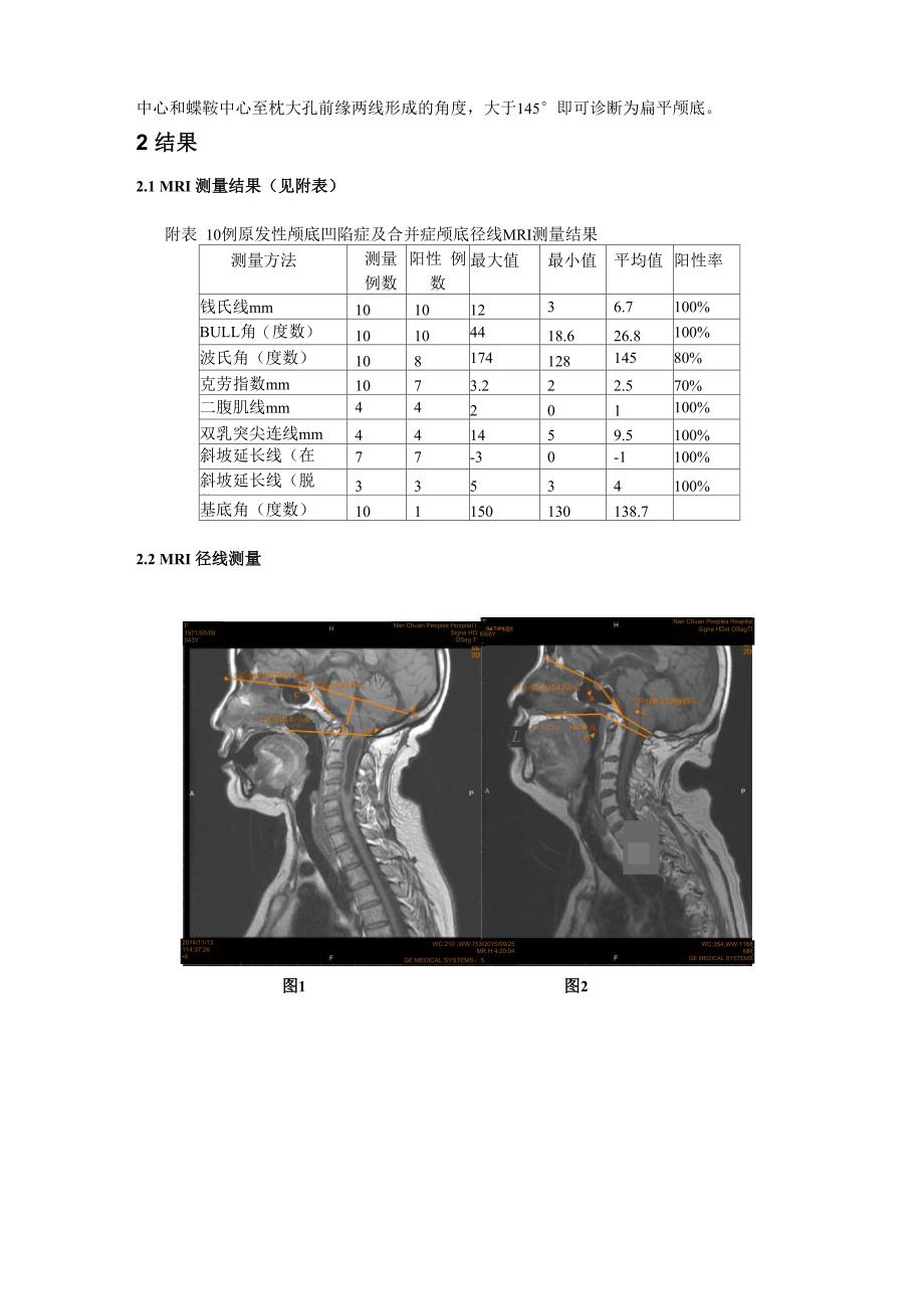 颅底凹陷症影像学诊断_第2页