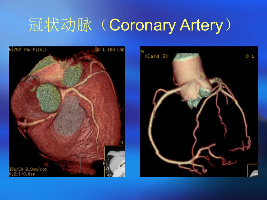 冠脉解剖及DSCT冠脉检查方法及应用_第4页