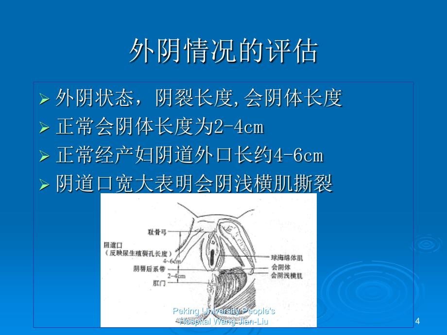 盆腔器官脱垂诊治相关问题课件幻灯PPT_第4页