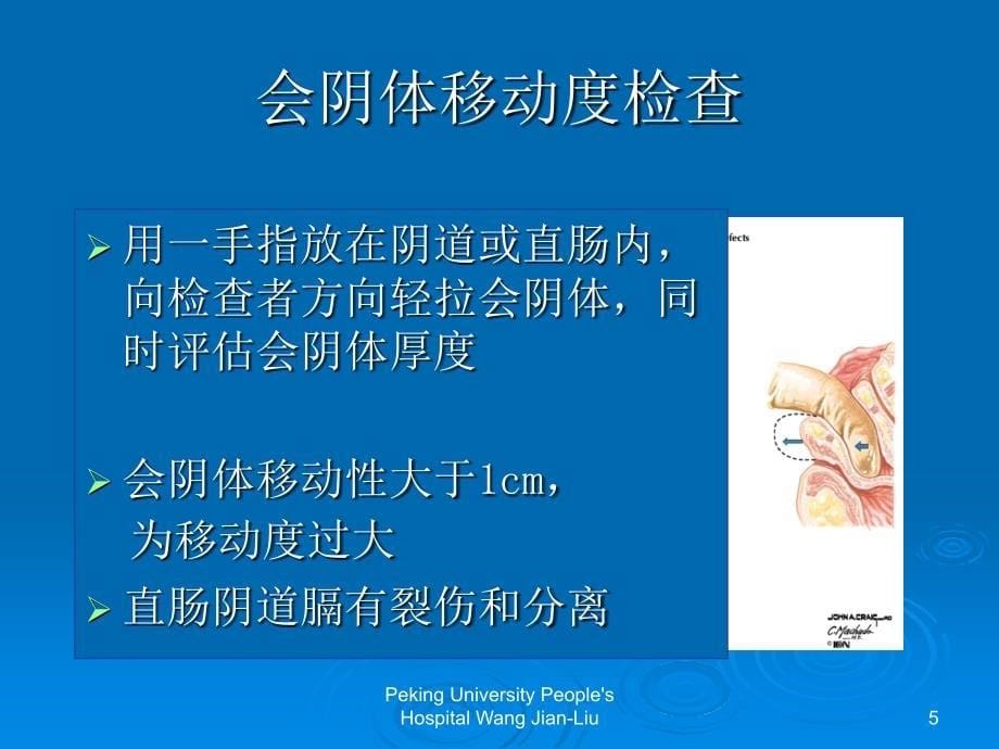 盆腔器官脱垂诊治相关问题课件幻灯PPT_第5页