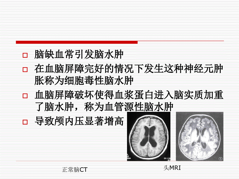 围术保护进展.._第4页