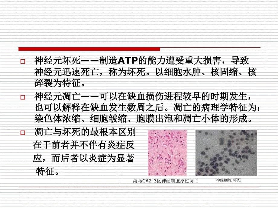 围术保护进展.._第5页