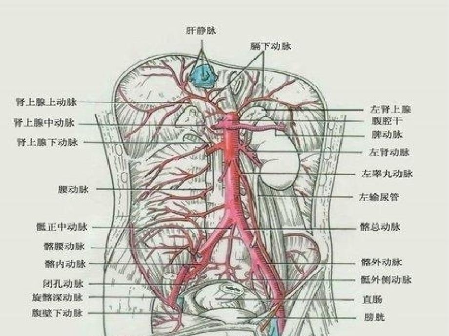 腹主动脉瘤的护理(讲课)课件_第3页