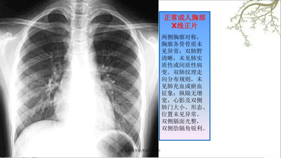 执业医师技能考试x线诊断_第2页