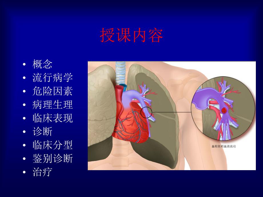 内科学教学课件：肺血栓栓塞症_第4页