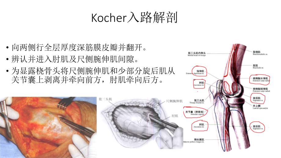 肘关节外侧入路解剖_第2页