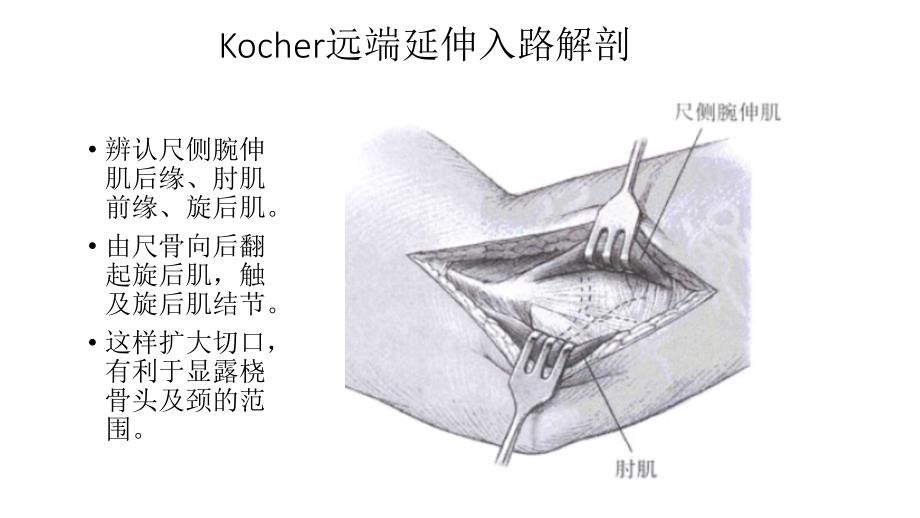 肘关节外侧入路解剖_第4页