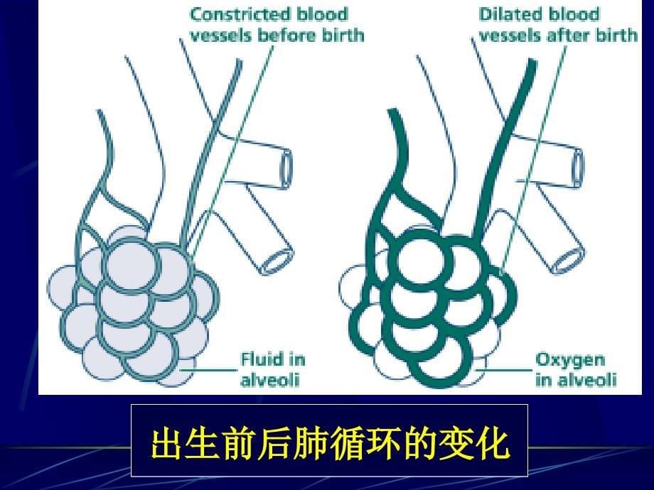 新生儿窒息复苏_第5页