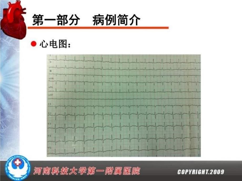 最新反复胸闷气短发作1例临床分析教学课件精品课件_第5页