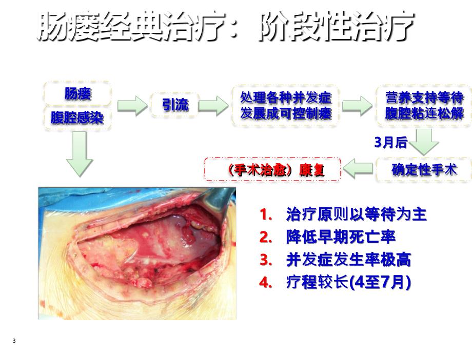 肠瘘治疗进展ppt课件.ppt_第3页