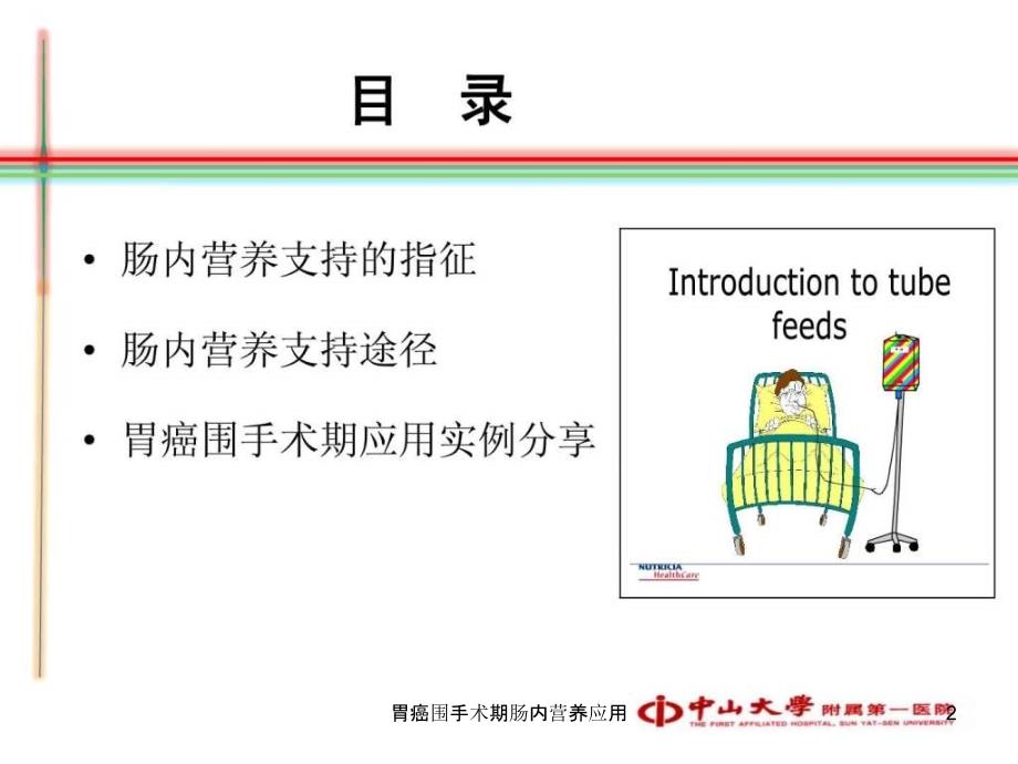 胃癌围手术期肠内营养应用课件_第2页