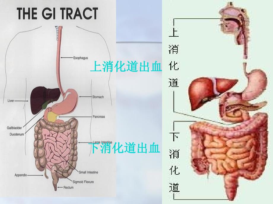 内科护理学第十二节上消化道大出血_第2页