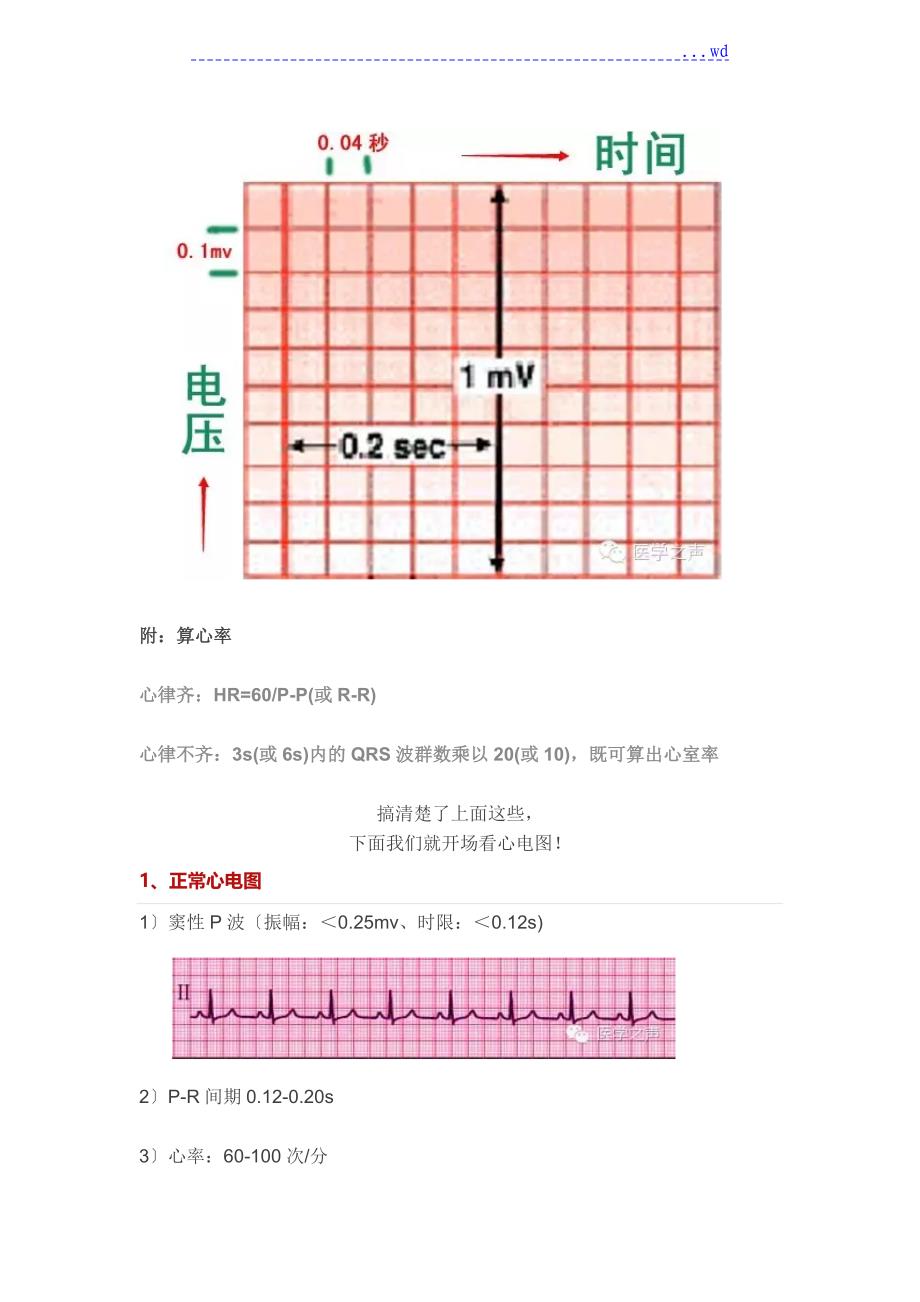 临床常见的11种心电图_第3页