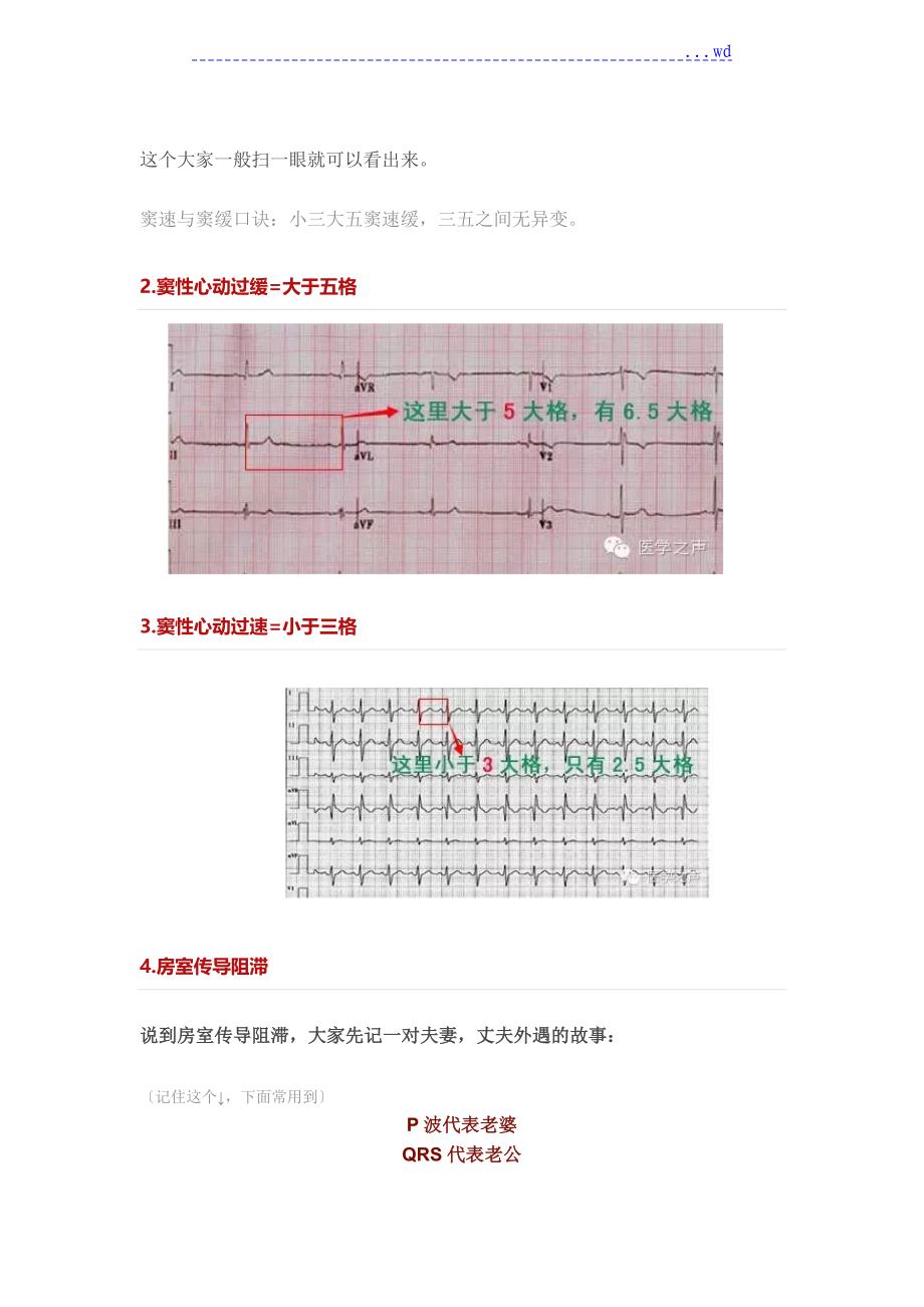 临床常见的11种心电图_第4页