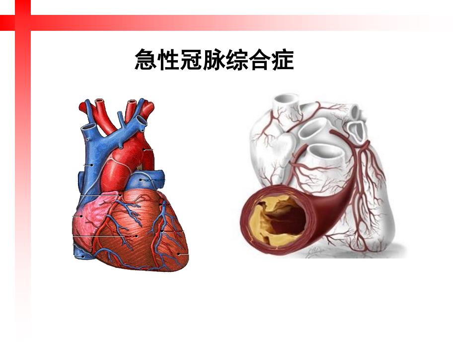 学校安全救护培训PPT课件_第4页