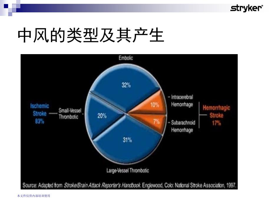 脑动脉瘤的介入治疗PPT课件_第4页