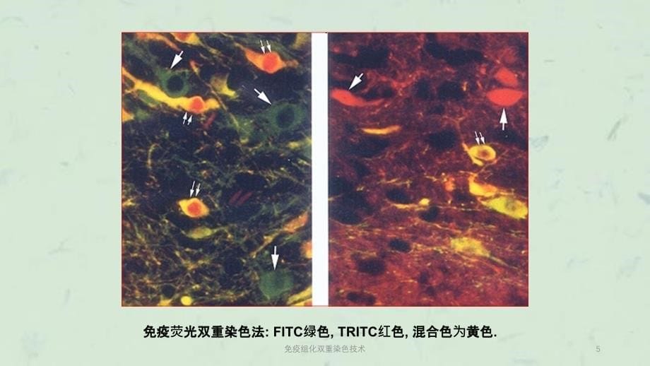 免疫组化双重染色技术课件_第5页