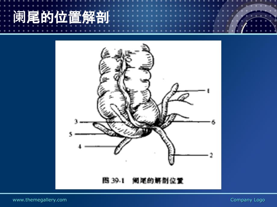 阑尾炎诊断治疗手术课件_第3页