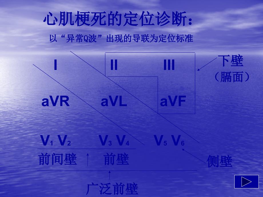 心肌梗死心电图的动态变化_第2页