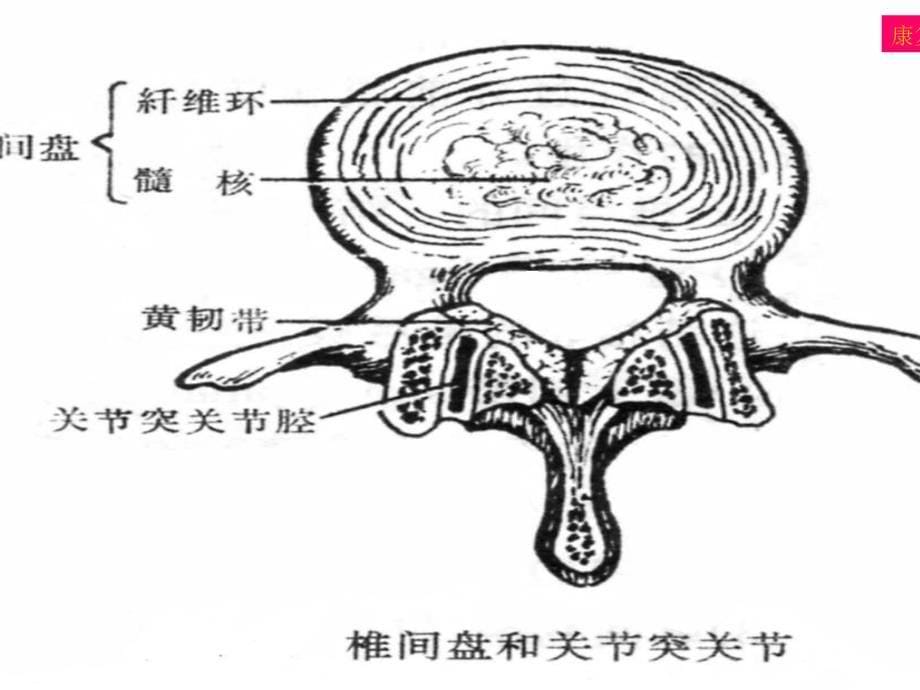 腰椎间盘突出症康复.ppt_第5页