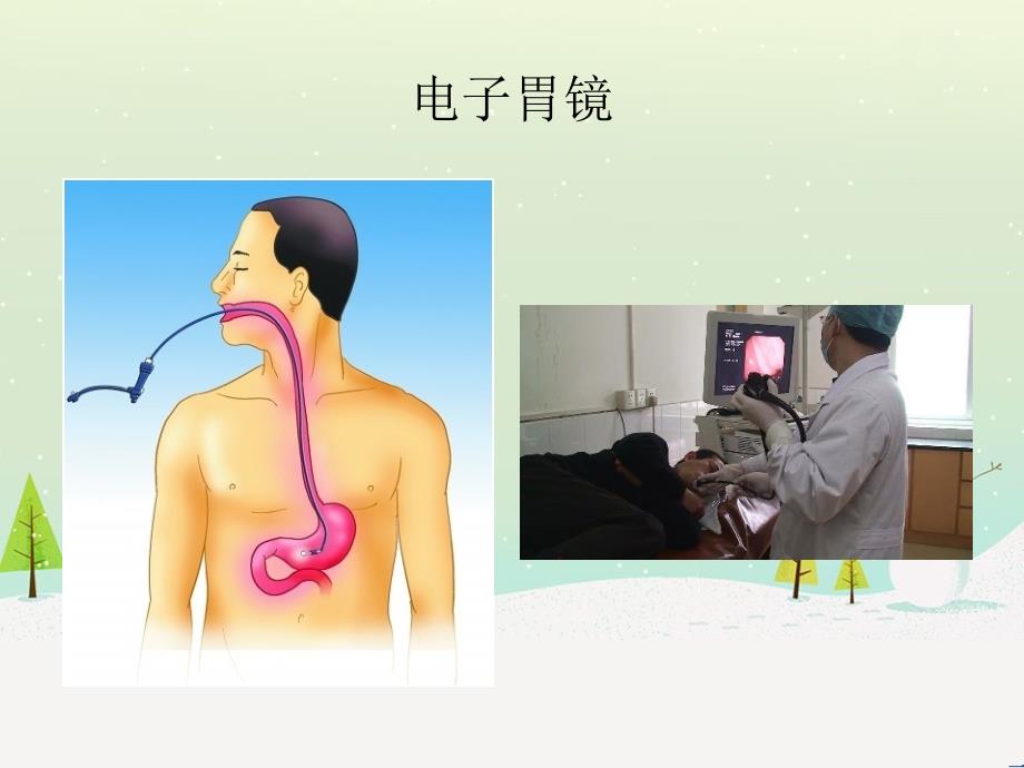 消化内镜操作诊断及治疗_第5页