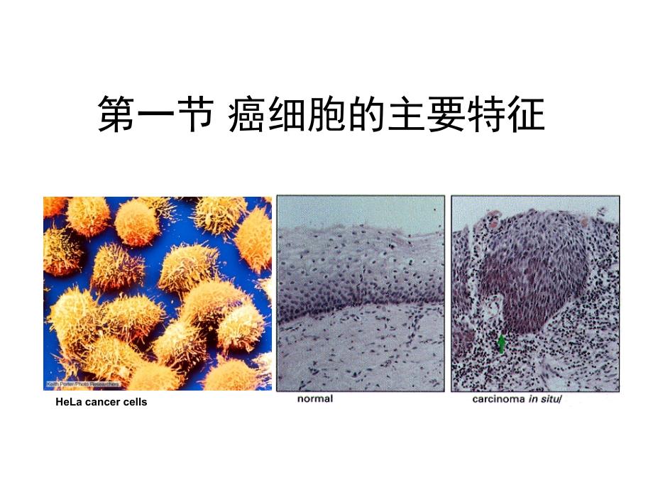 肿瘤细胞课件_第3页