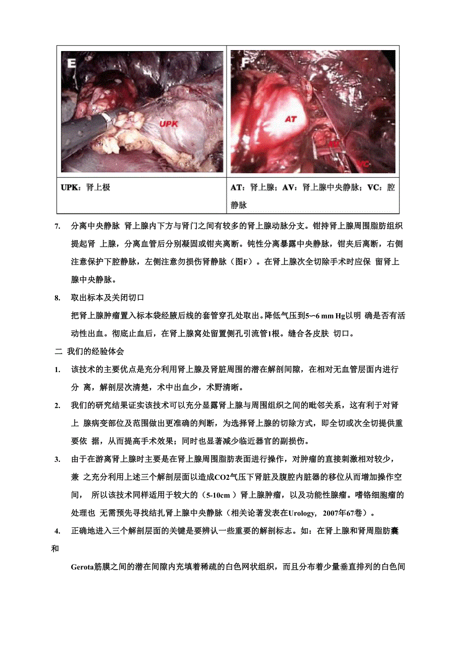 解剖性后腹腔镜肾上腺切除术-张旭 2_第4页