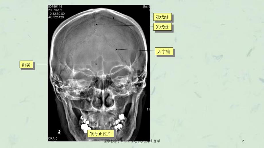 医学影像诊断中枢神经系统医学影像学课件_第2页