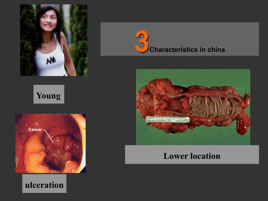 结直肠疾病英文课件.ppt_第3页