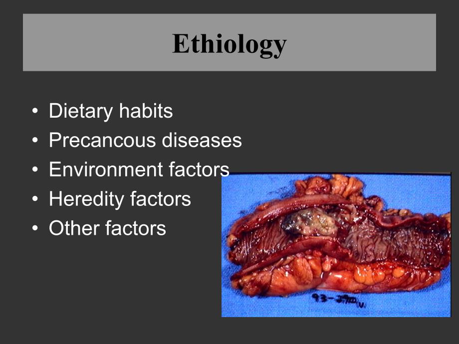 结直肠疾病英文课件.ppt_第4页