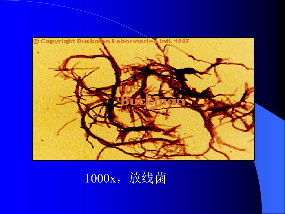 放线菌真菌名师编辑PPT课件_第2页