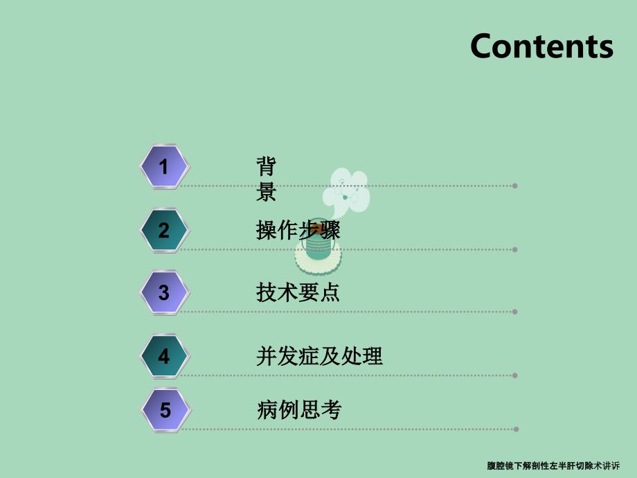 腹腔镜下解剖性左半肝切除术讲诉_第2页