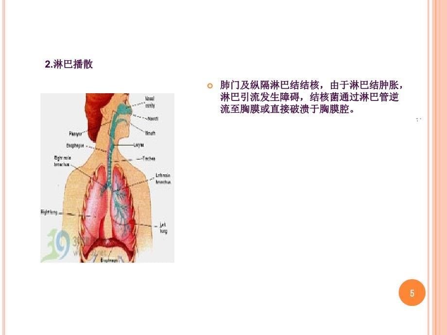 结核性胸膜炎的护理ppt课件_第5页