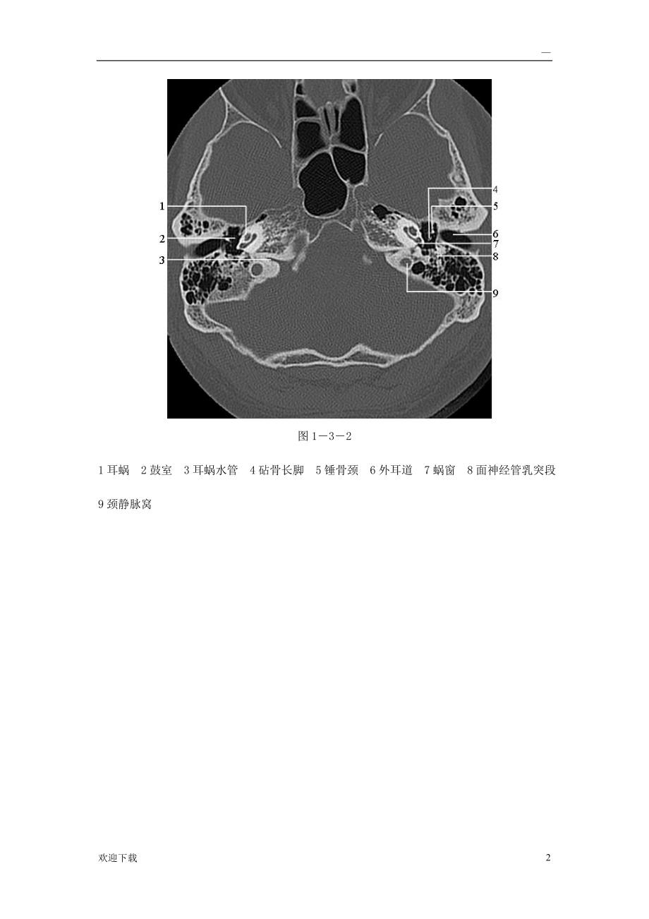 颞骨正常CT解剖(附图)_第2页