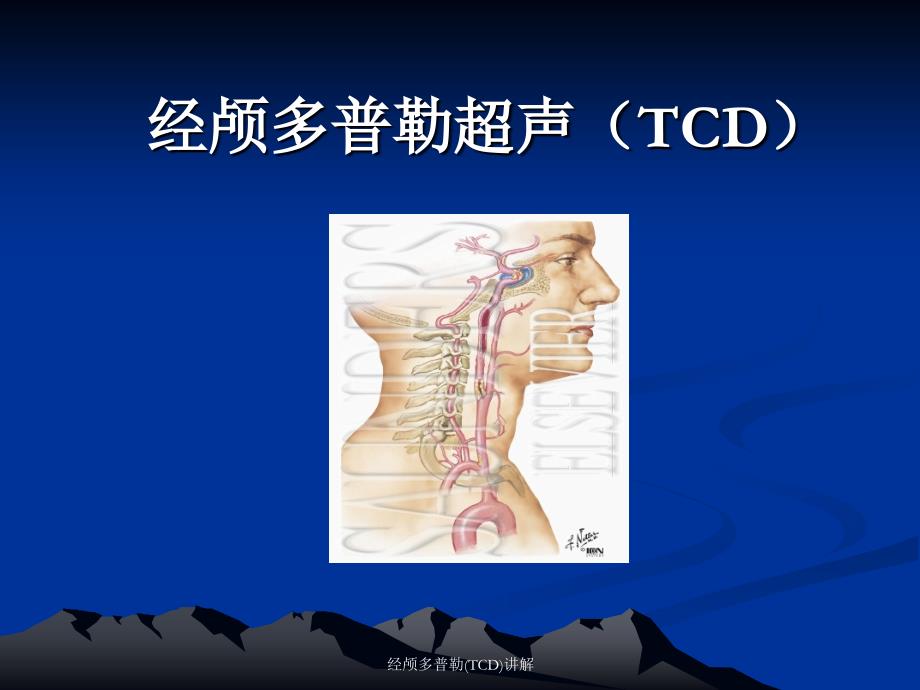 经颅多普勒(TCD)讲解_第1页