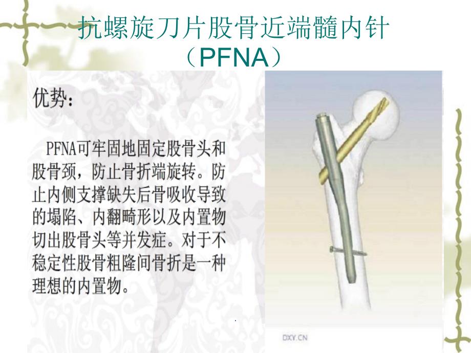 股骨粗隆间骨折手术配合课件_第2页