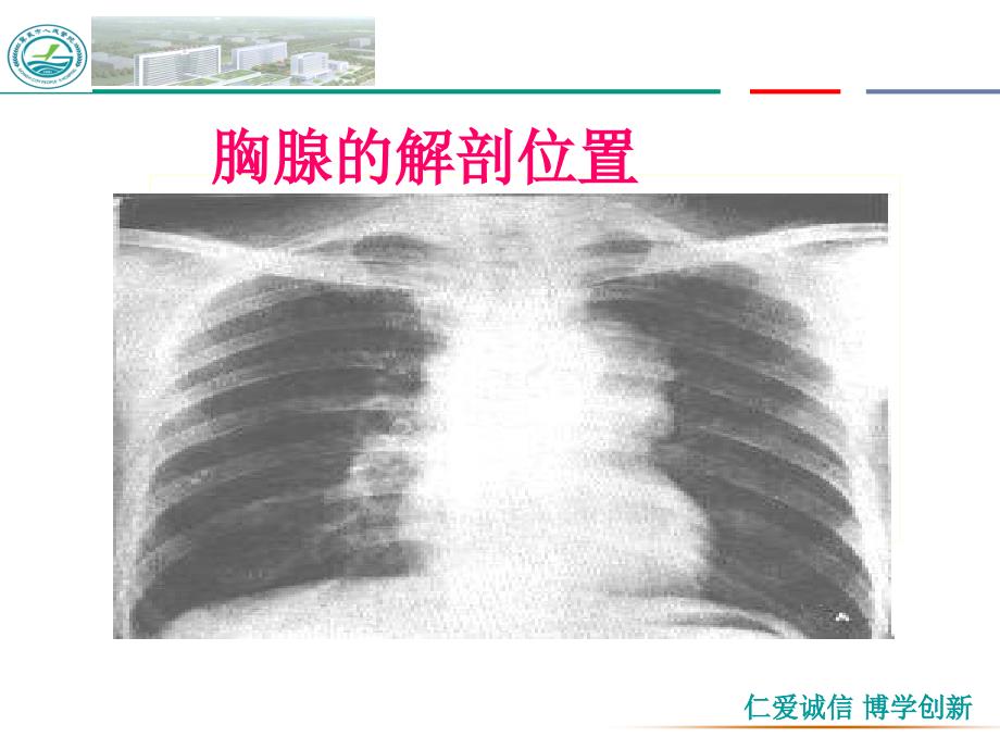 胸腺瘤合并重症肌无力患者的护理_第4页