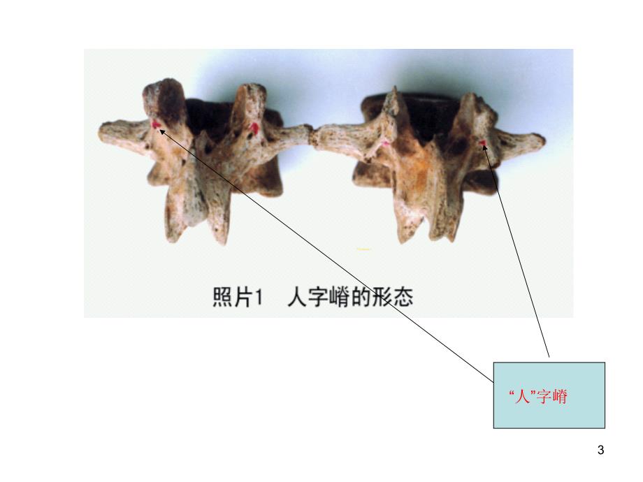 人子脊解剖PPT参考课件_第3页