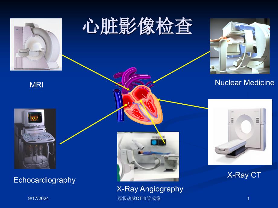 冠状动脉CT血管成像课件_第1页