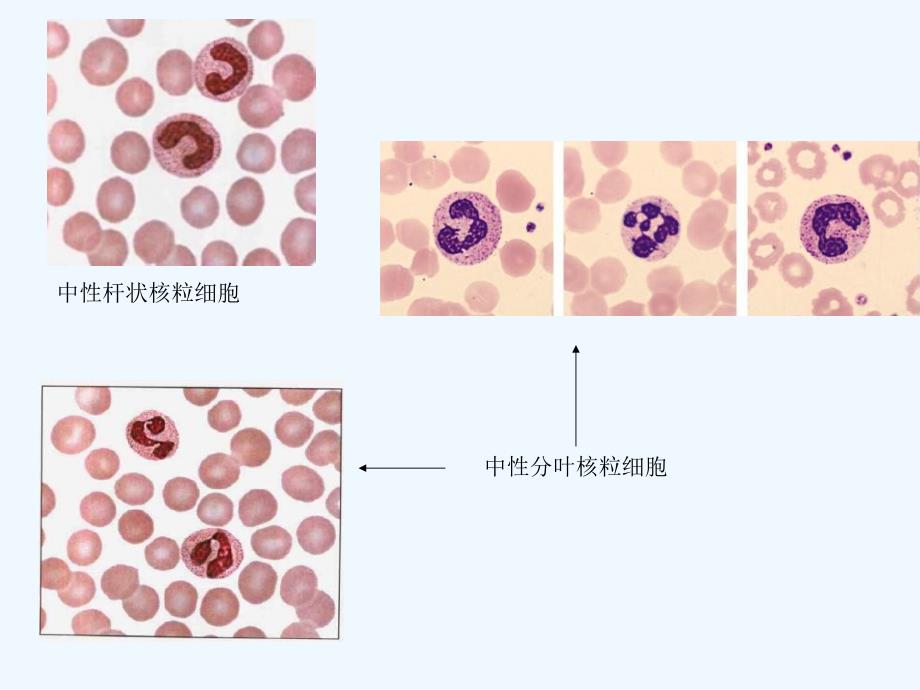 白细胞形态与分类_第4页