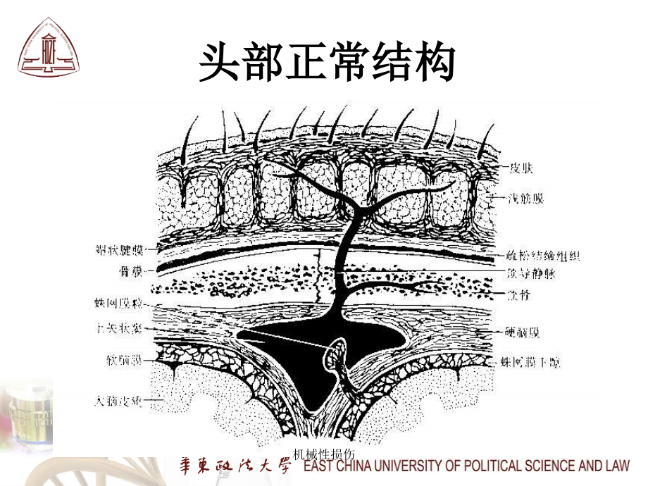 机械性损伤课件_第5页