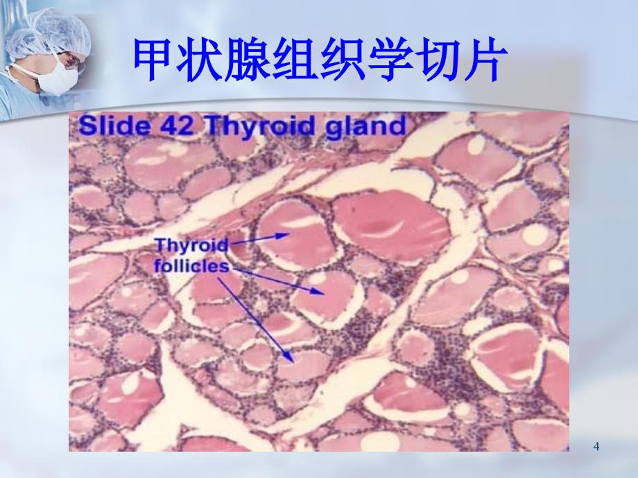 甲状腺结节的诊断与治疗ppt课件_第4页