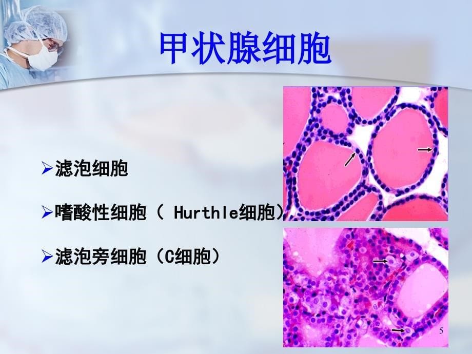 甲状腺结节的诊断与治疗ppt课件_第5页