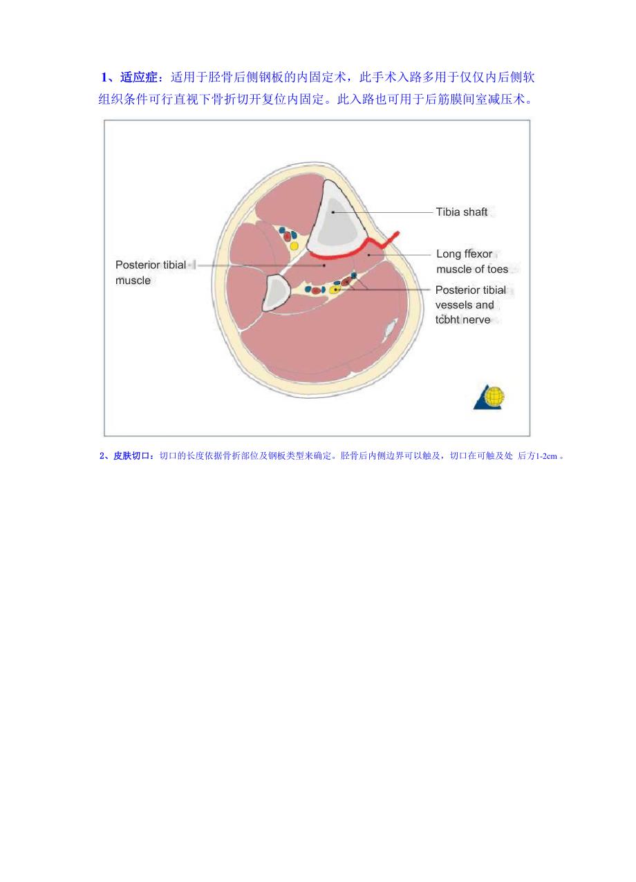 胫骨后内侧手术入路_第1页
