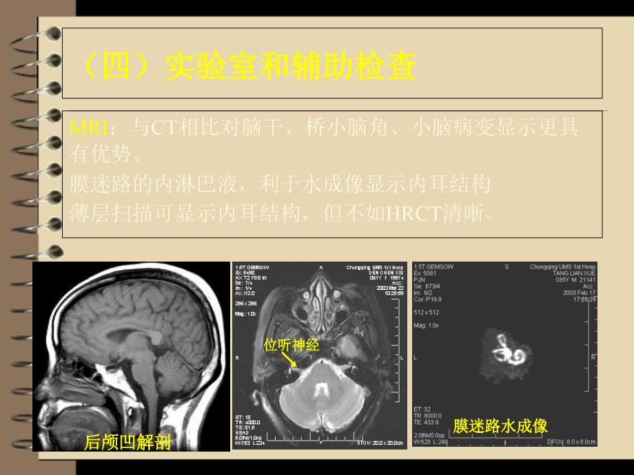 眩晕诊治新进展(二)_第1页