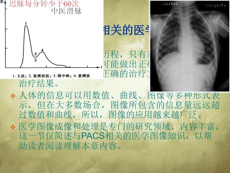 医学影像存储与传输系统_第5页