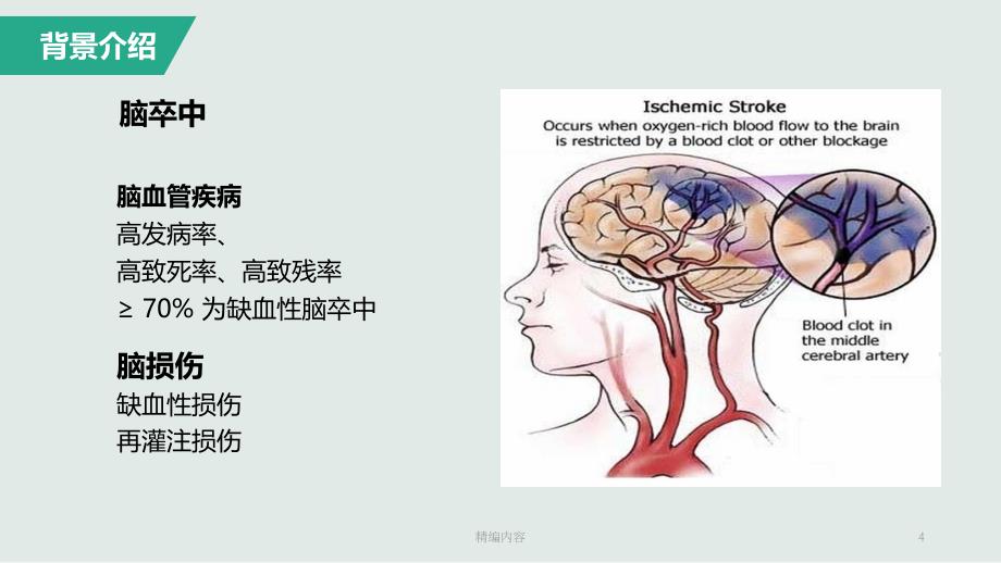 缺血性脑卒中治疗药物深度分析_第4页