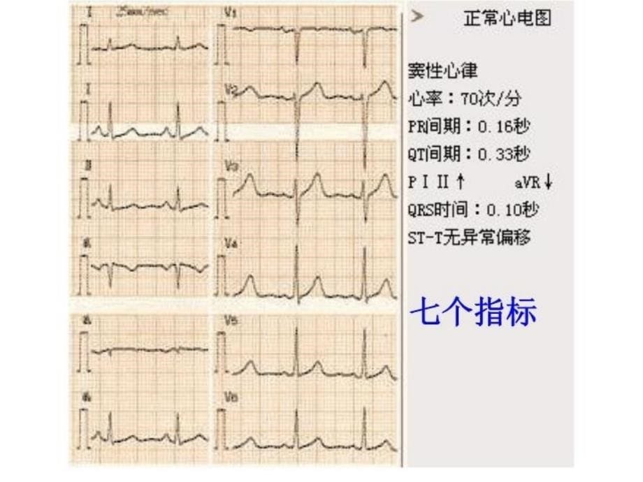 最新心电图4PPT课件_第5页