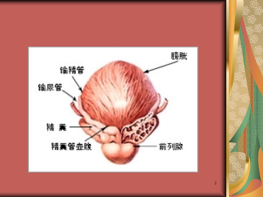 前列腺术后膀胱痉挛的相关因素PPT课件_第2页